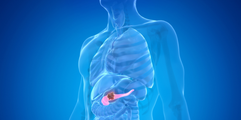 drug for pancreatic cancer